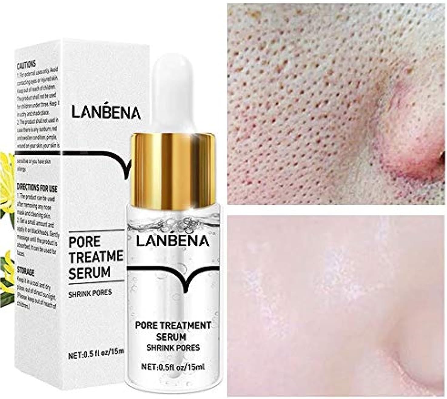 https://cdn.shopify.com/s/files/1/0777/4122/8329/files/lanbena-pore-solution-serum-original-1295356.jpg?v=1759259550